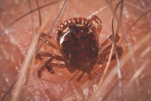 Tick Bite Into Human Skin